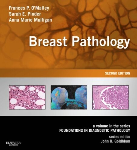 Breast Pathology: A Volume in the Series: Foundations in Diagnostic Pathology 2nd Edition