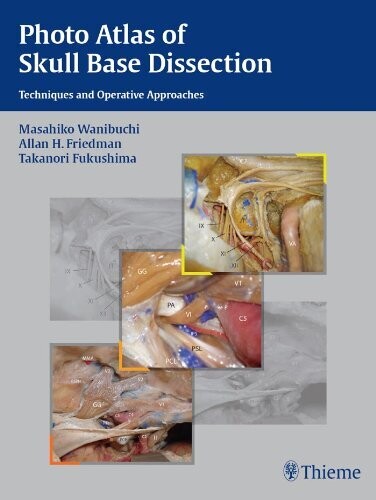 Photo Atlas of Skull Base Dissection: Techniques and Operative Approaches 1st Edition