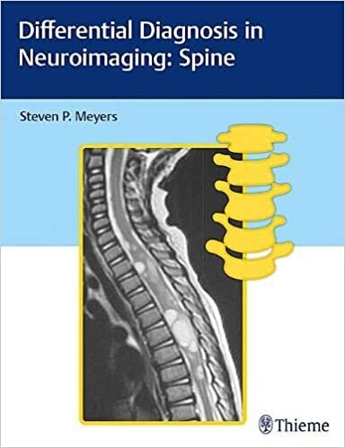 Differential Diagnosis in Neuroimaging: Spine 1st Edition