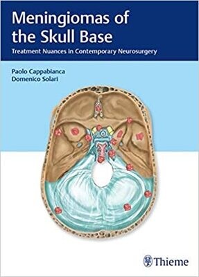 Meningiomas of the Skull Base: Treatment Nuances in Contemporary Neurosurgery 1st Edition,