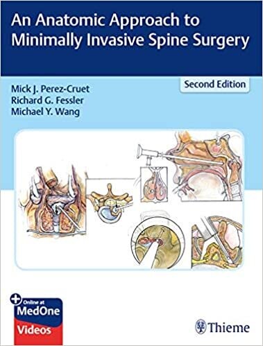 An Anatomic Approach to Minimally Invasive Spine Surgery 2nd Edition