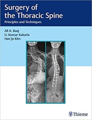 Surgery of the Thoracic Spine: Principles and Techniques 1st Edition