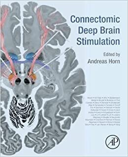 Connectomic Deep Brain Stimulation 1st Edition
