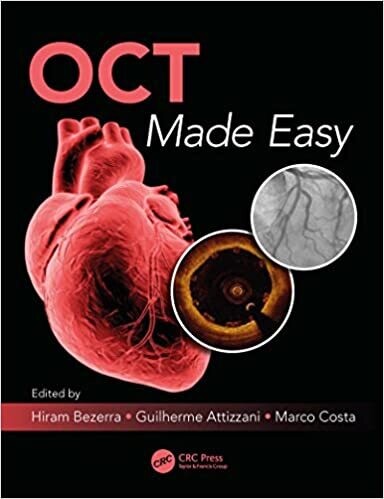 OCT Made Easy 1st Edition
