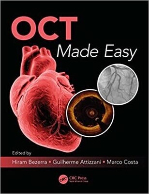 OCT Made Easy 1st Edition