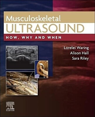 Musculoskeletal Ultrasound How, Why and When