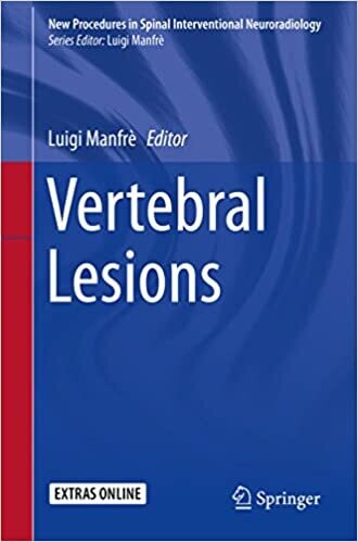 Vertebral Lesions (New Procedures in Spinal Interventional Neuroradiology) 1st ed. 2017 Edition