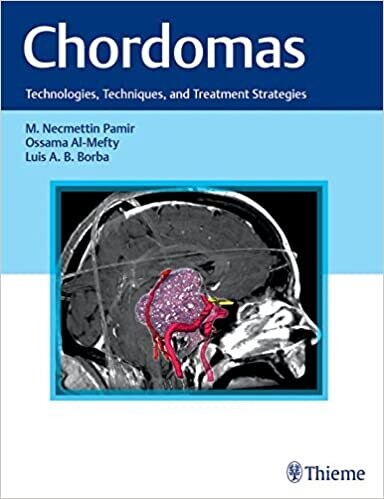 Chordomas: Technologies, Techniques, and Treatment Strategies 1st Edition