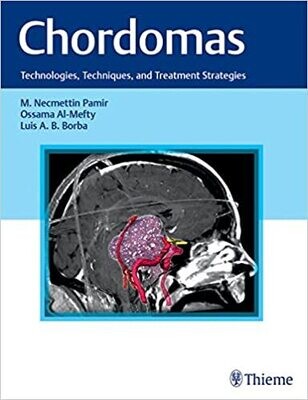 Chordomas: Technologies, Techniques, and Treatment Strategies 1st Edition