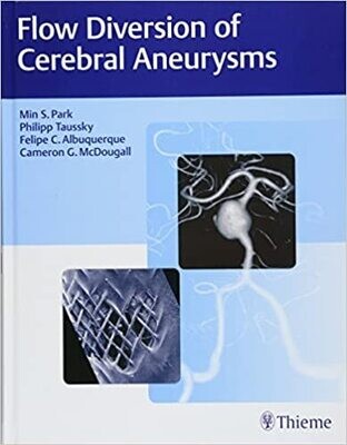 Flow Diversion of Cerebral Aneurysms 1st Edition