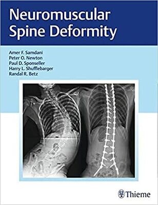 Neuromuscular Spine Deformity 1st Edition