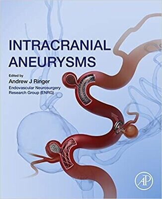 Intracranial Aneurysms 1st Edition