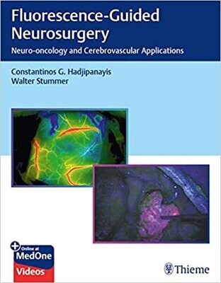 Fluorescence-Guided Neurosurgery: Neuro-oncology and Cerebrovascular Applications 1st Edition
