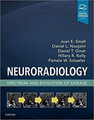 Neuroradiology: Spectrum and Evolution of Disease 1st Edition