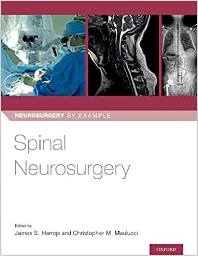 Spinal Neurosurgery (Neurosurgery by Example Book 3) 1st Edition