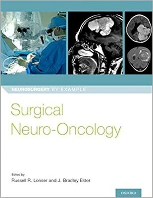 Surgical Neuro-Oncology (Neurosurgery by Example) 1st Edition