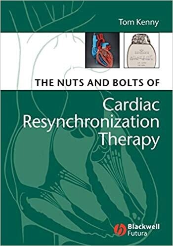 The Nuts and Bolts of Cardiac Resynchronization Therapy 1st Edition