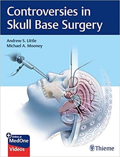 Controversies in Skull Base Surgery 1st Edition