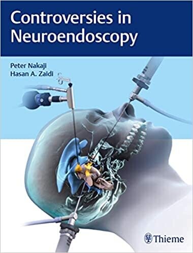 Controversies in Neuroendoscopy 1st Edition