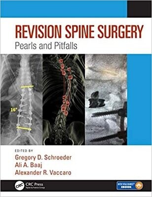 Revision Spine Surgery: Pearls and Pitfalls 1st Edition
