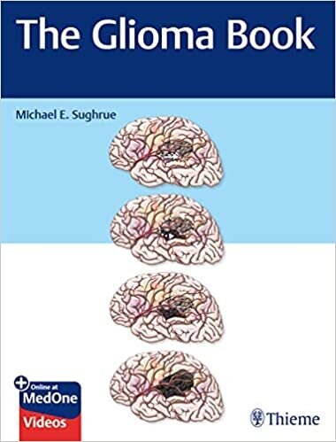The Glioma Book 1st Edition