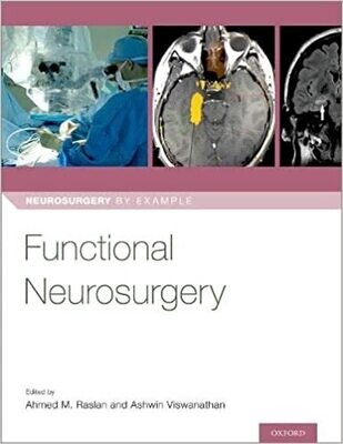 Functional Neurosurgery (Neurosurgery by Example) 1st Edition