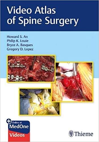 Video Atlas of Spine Surgery 1st Edition