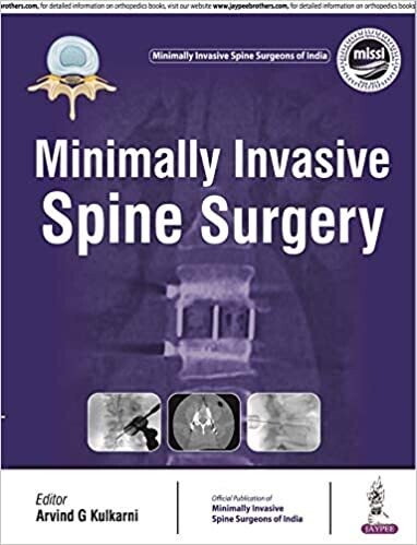 Minimally Invasive Spine Surgery 1st Edition