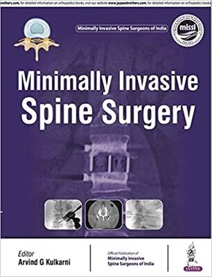 Minimally Invasive Spine Surgery 1st Edition