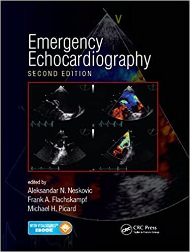 Emergency Echocardiography