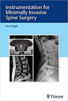 Instrumentation for Minimally Invasive Spine Surgery 1st Edition