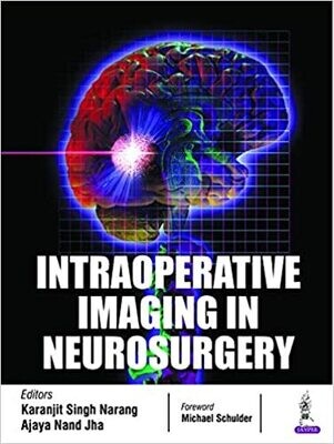 Intraoperative Imaging in Neurosurgery 1st Edition