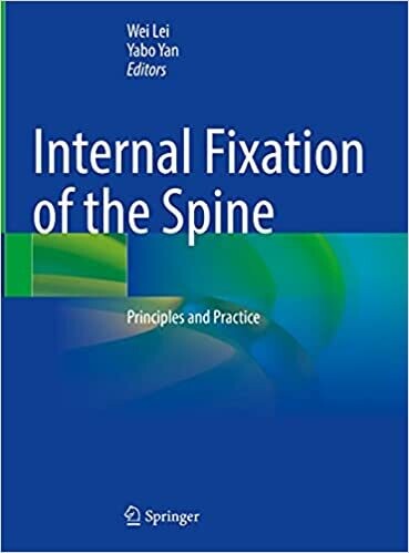 Internal Fixation of the Spine: Principles and Practice 1st ed. 2021 Edition