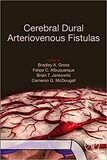 Cerebral Dural Arteriovenous Fistulas 1st Edition