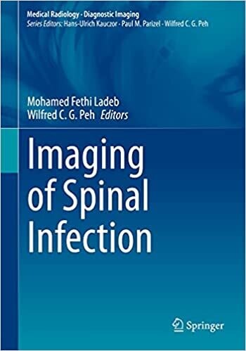 Imaging of Spinal Infection (Medical Radiology) 1st ed. 2021 Edition