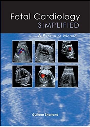 Fetal Cardiology Simplified: A Practical Manual 1st Edition