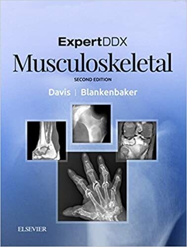 ExpertDDx: Musculoskeletal E-Book 2nd Edition,