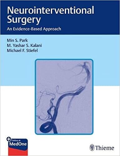Neurointerventional Surgery: An Evidence-Based Approach 1st Edition
