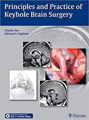 Principles and Practice of Keyhole Brain Surgery 1st Edition