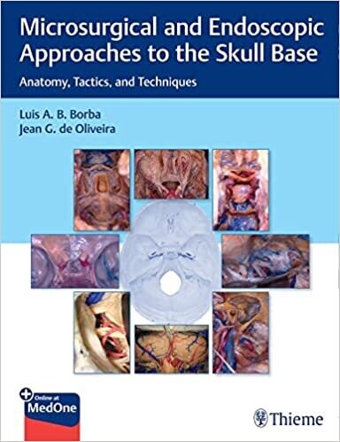 Microsurgical and Endoscopic Approaches to the Skull Base: Anatomy, Tactics, and Techniques 1st Edition