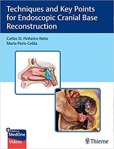 Techniques and Key Points for Endoscopic Cranial Base Reconstruction 1st Edition
