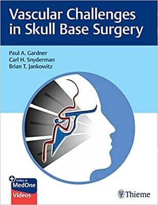 Vascular Challenges in Skull Base Surgery 1st Edition