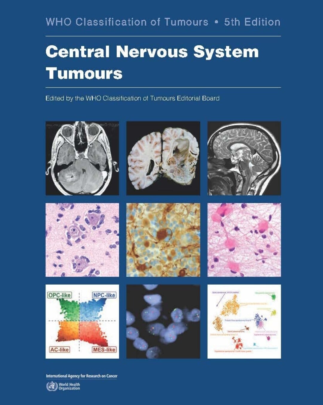 Central Nervous System Tumours: WHO Classification of Tumours 5th Edition 2022