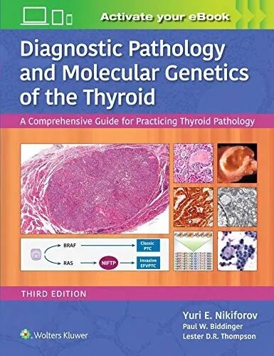 Diagnostic Pathology and Molecular Genetics of the Thyroid A Comprehensive Guide for Practicing Thyroid Pathology 3rd Edition 2019