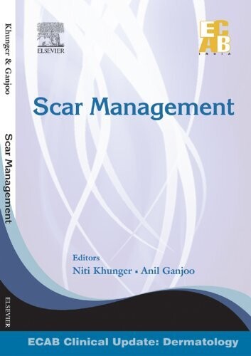 Scar Management - ECAB