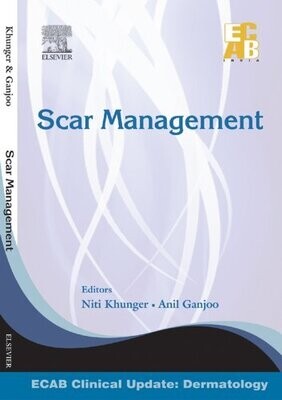 Scar Management - ECAB