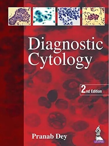 Diagnostic Cytology 2nd Edition 2022