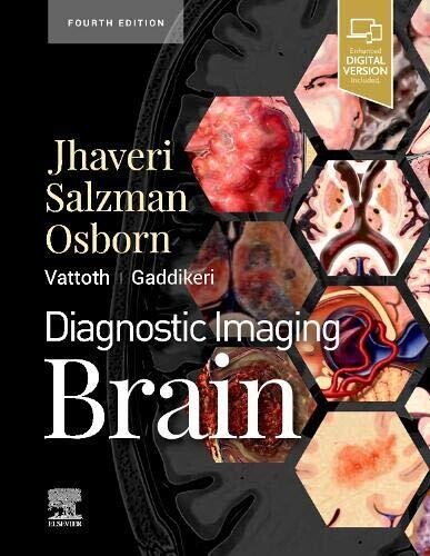 Diagnostic Imaging: Brain E-Book 4th Edition