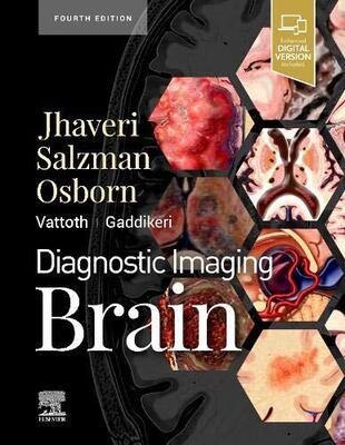 Diagnostic Imaging: Brain E-Book 4th Edition
