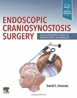 Endoscopic Craniosynostosis Surgery E-Book